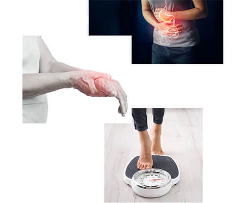 Gut health and weight loss